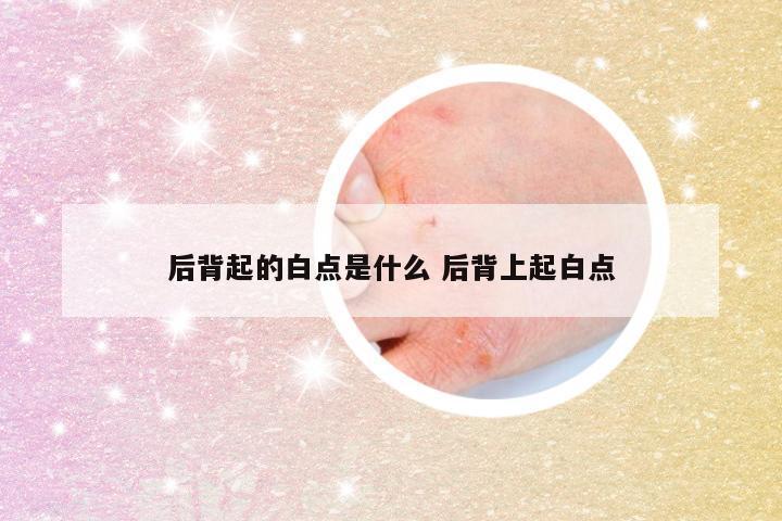 后背起的白点是什么 后背上起白点