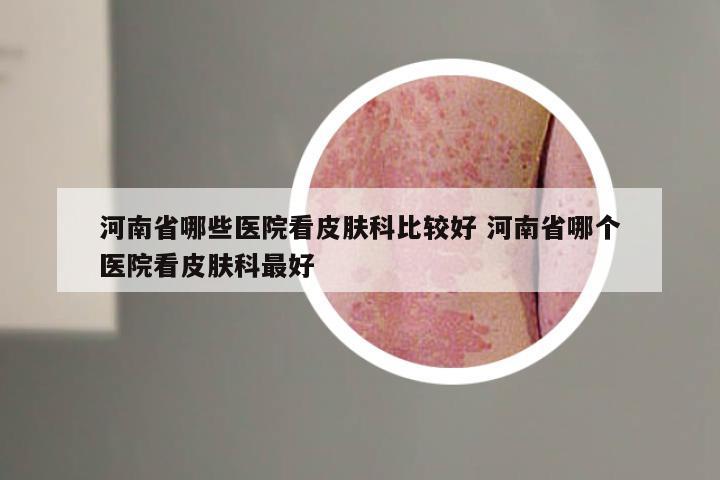 河南省哪些医院看皮肤科比较好 河南省哪个医院看皮肤科最好