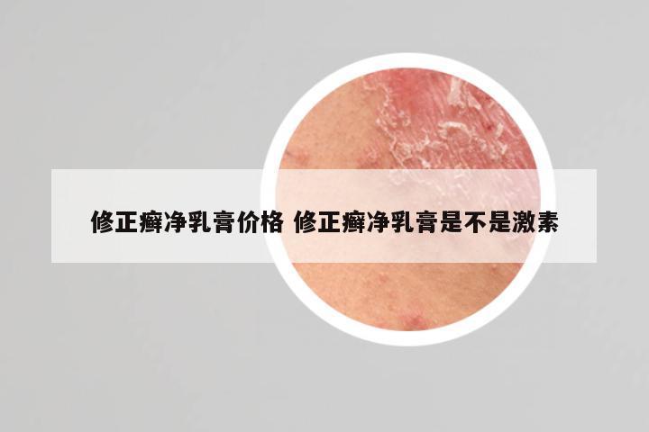 修正癣净乳膏价格 修正癣净乳膏是不是激素