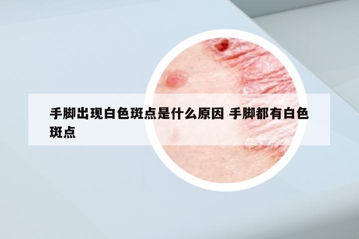 手脚出现白色斑点是什么原因 手脚都有白色斑点