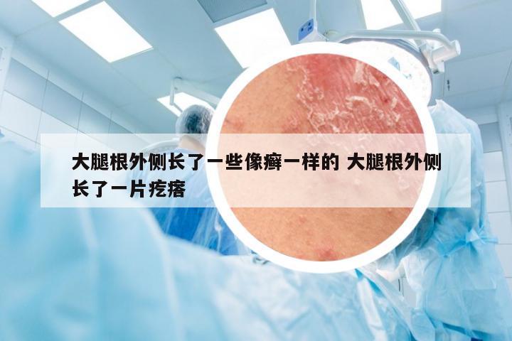 大腿根外侧长了一些像癣一样的 大腿根外侧长了一片疙瘩