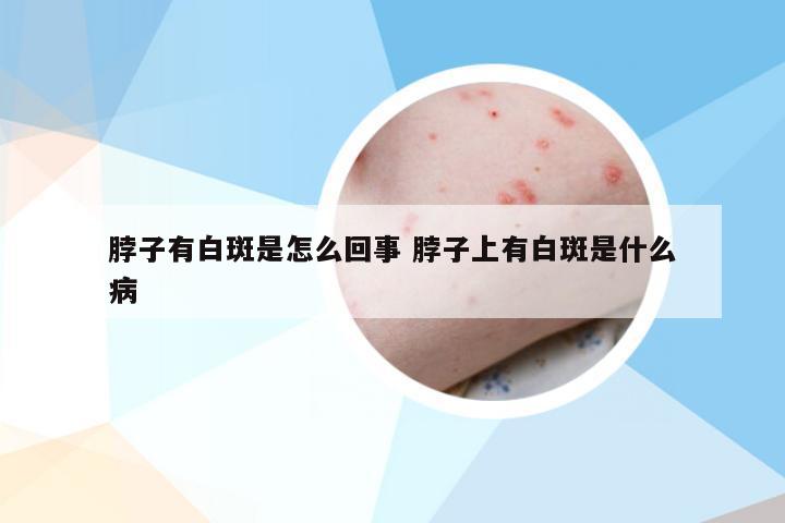 脖子有白斑是怎么回事 脖子上有白斑是什么病