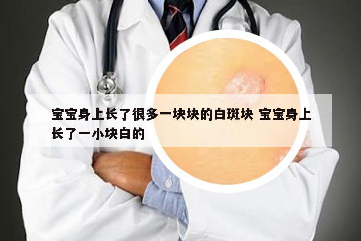 宝宝身上长了很多一块块的白斑块 宝宝身上长了一小块白的