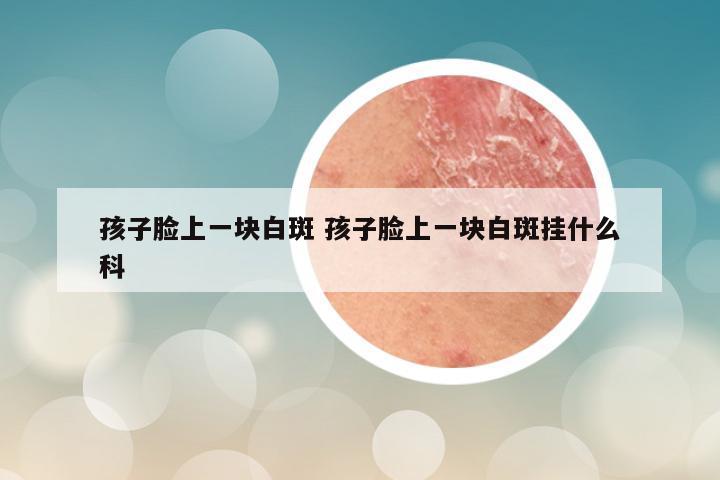 孩子脸上一块白斑 孩子脸上一块白斑挂什么科