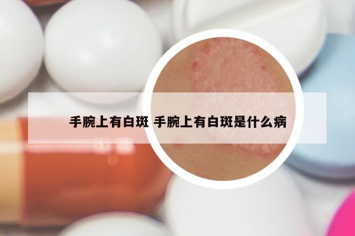 手腕上有白斑 手腕上有白斑是什么病