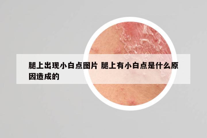 腿上出现小白点图片 腿上有小白点是什么原因造成的