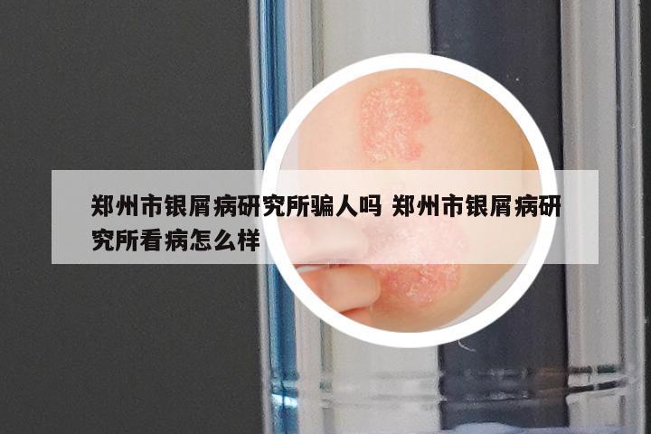 郑州市银屑病研究所骗人吗 郑州市银屑病研究所看病怎么样