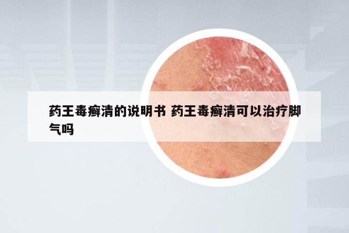 药王毒癣清的说明书 药王毒癣清可以治疗脚气吗