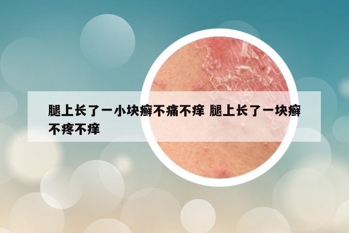 腿上长了一小块癣不痛不痒 腿上长了一块癣不疼不痒