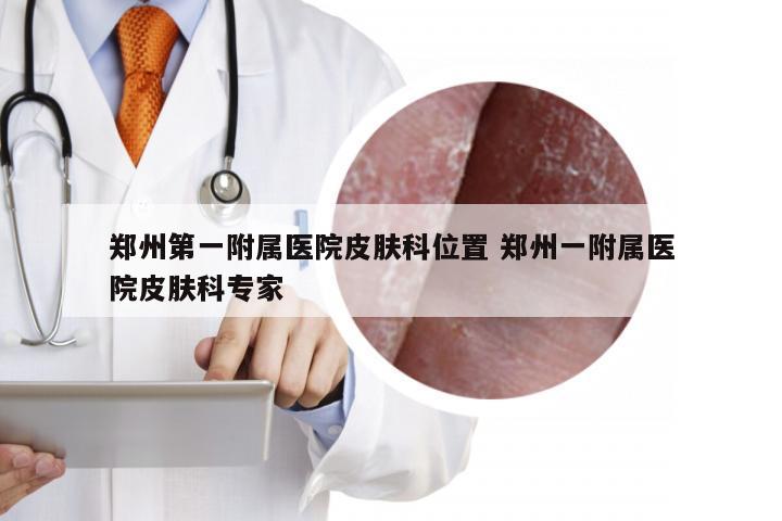 郑州第一附属医院皮肤科位置 郑州一附属医院皮肤科专家