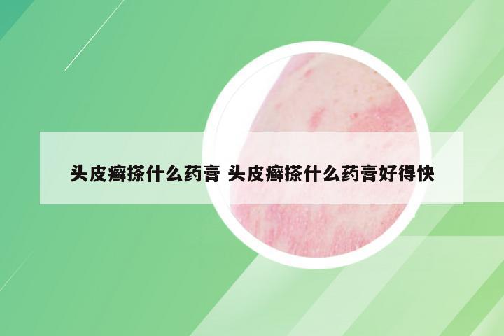 头皮癣搽什么药膏 头皮癣搽什么药膏好得快