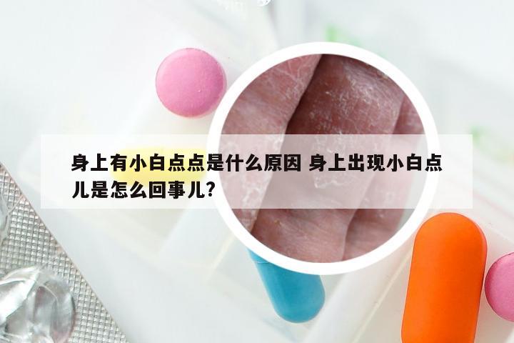 身上有小白点点是什么原因 身上出现小白点儿是怎么回事儿?