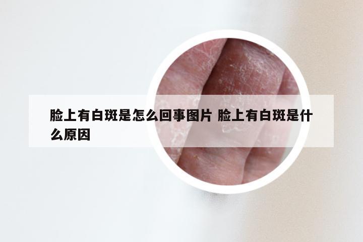 脸上有白斑是怎么回事图片 脸上有白斑是什么原因