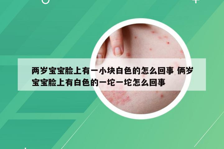 两岁宝宝脸上有一小块白色的怎么回事 俩岁宝宝脸上有白色的一坨一坨怎么回事