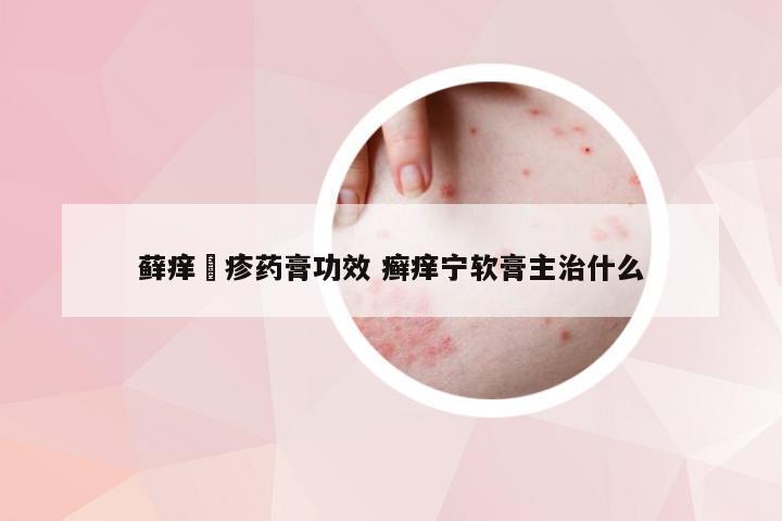 藓痒瑇疹药膏功效 癣痒宁软膏主治什么