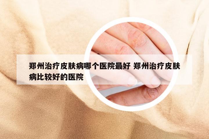 郑州治疗皮肤病哪个医院最好 郑州治疗皮肤病比较好的医院