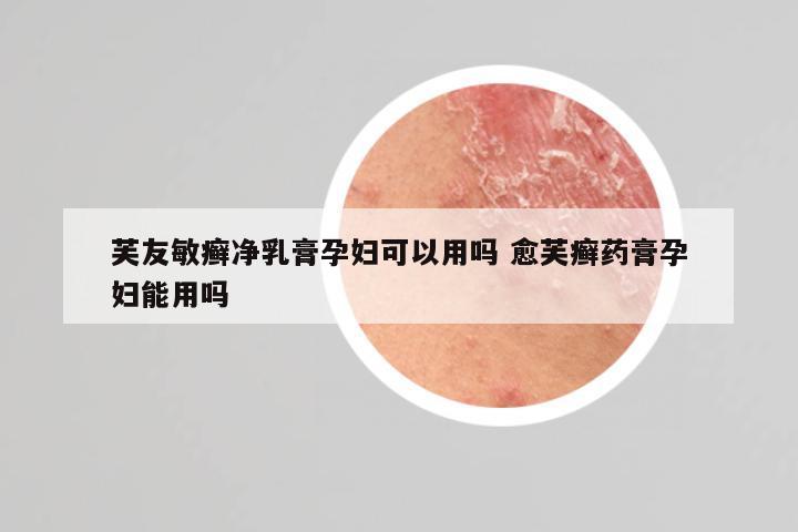 芙友敏癣净乳膏孕妇可以用吗 愈芙癣药膏孕妇能用吗