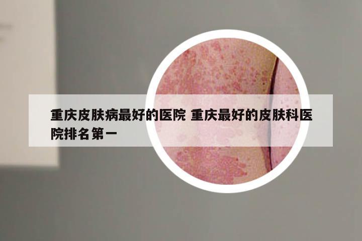 重庆皮肤病最好的医院 重庆最好的皮肤科医院排名第一