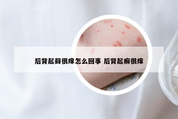 后背起藓很痒怎么回事 后背起癣很痒