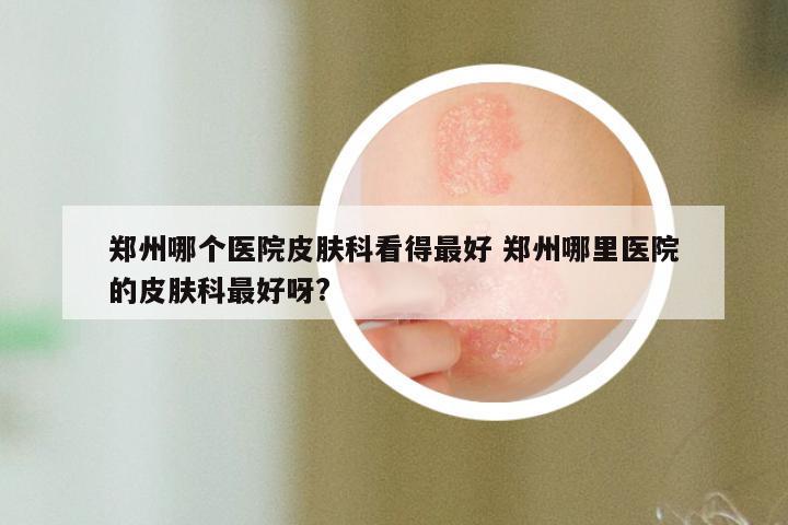 郑州哪个医院皮肤科看得最好 郑州哪里医院的皮肤科最好呀?
