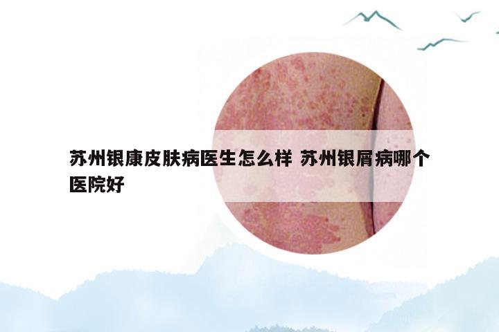 苏州银康皮肤病医生怎么样 苏州银屑病哪个医院好