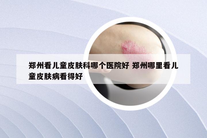 郑州看儿童皮肤科哪个医院好 郑州哪里看儿童皮肤病看得好