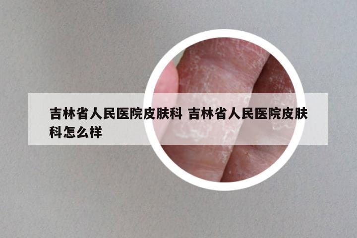 吉林省人民医院皮肤科 吉林省人民医院皮肤科怎么样