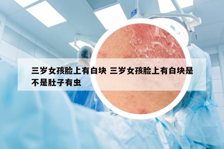 三岁女孩脸上有白块 三岁女孩脸上有白块是不是肚子有虫