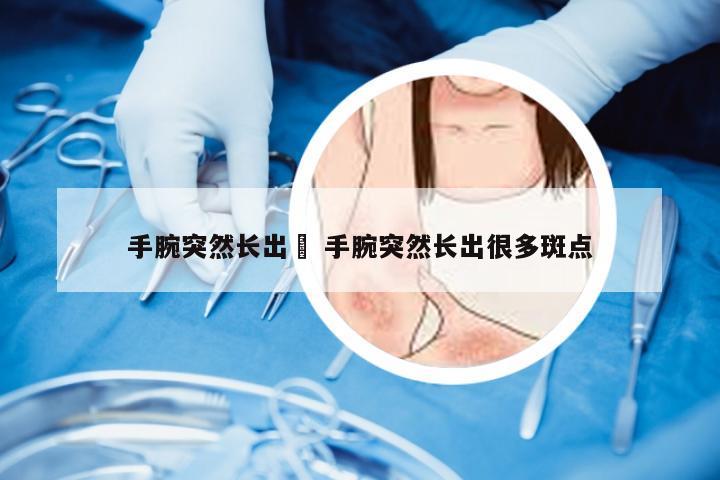 手腕突然长出廯 手腕突然长出很多斑点