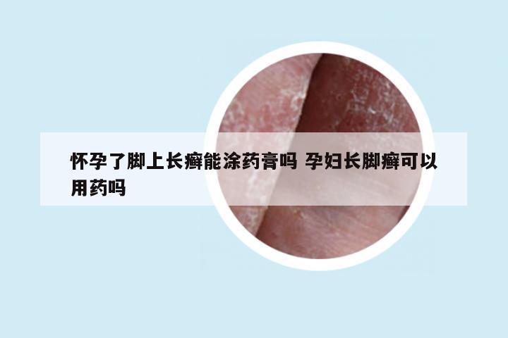 怀孕了脚上长癣能涂药膏吗 孕妇长脚癣可以用药吗