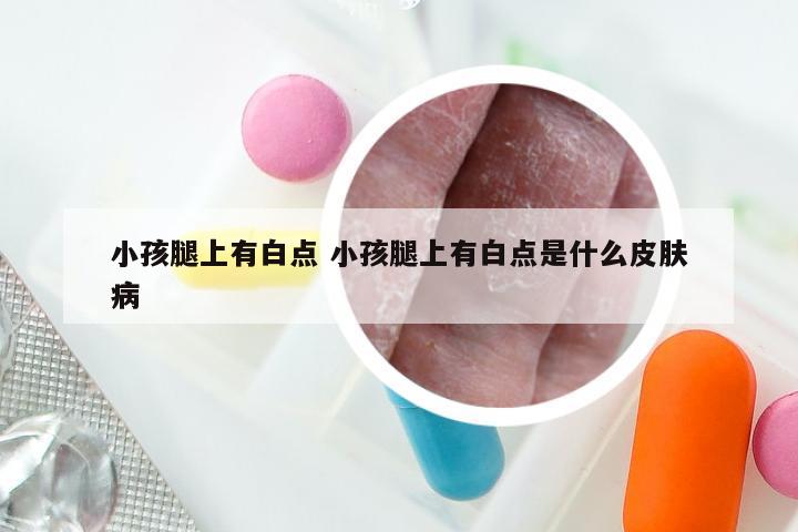 小孩腿上有白点 小孩腿上有白点是什么皮肤病