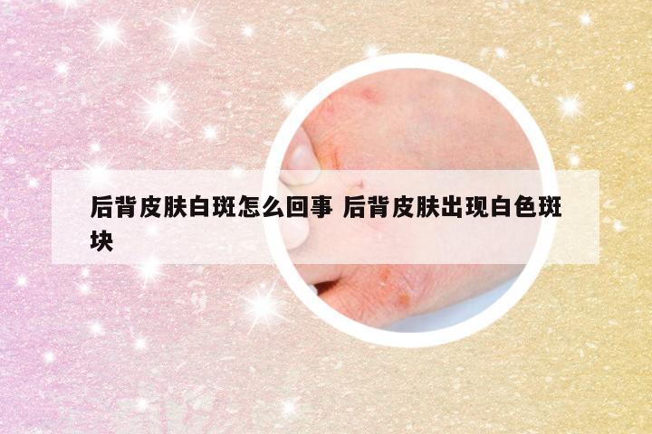 后背皮肤白斑怎么回事 后背皮肤出现白色斑块