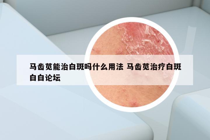 马齿苋能治白斑吗什么用法 马齿苋治疗白斑白白论坛