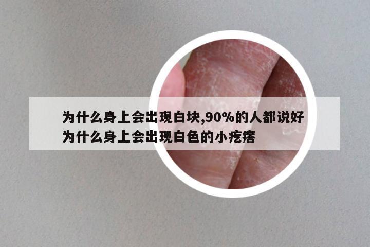 为什么身上会出现白块,90%的人都说好 为什么身上会出现白色的小疙瘩