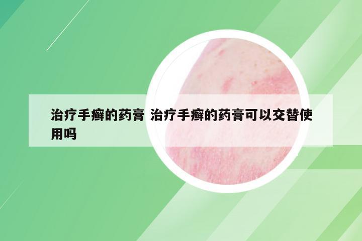 治疗手癣的药膏 治疗手癣的药膏可以交替使用吗