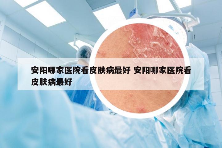 安阳哪家医院看皮肤病最好 安阳哪家医院看皮肤病最好