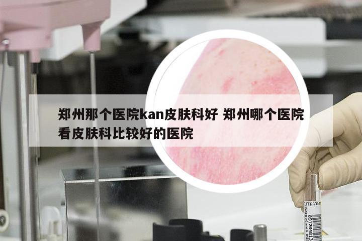 郑州那个医院kan皮肤科好 郑州哪个医院看皮肤科比较好的医院