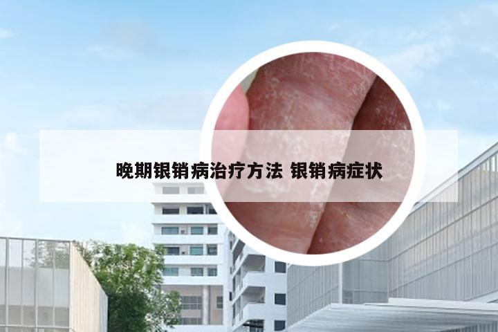 晚期银销病治疗方法 银销病症状