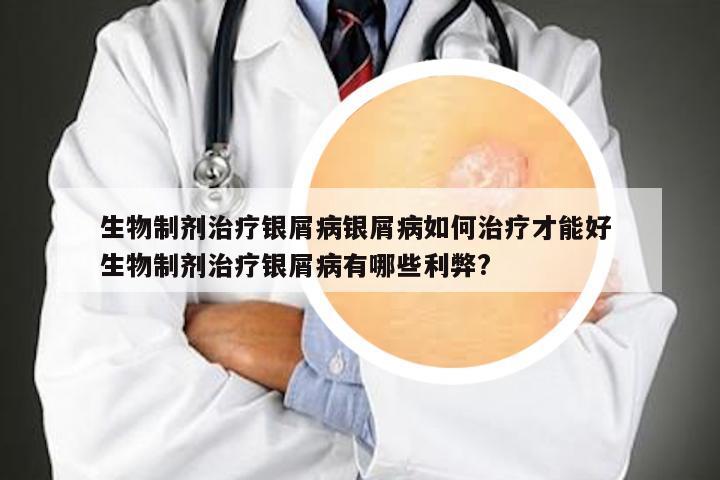 生物制剂治疗银屑病银屑病如何治疗才能好 生物制剂治疗银屑病有哪些利弊?