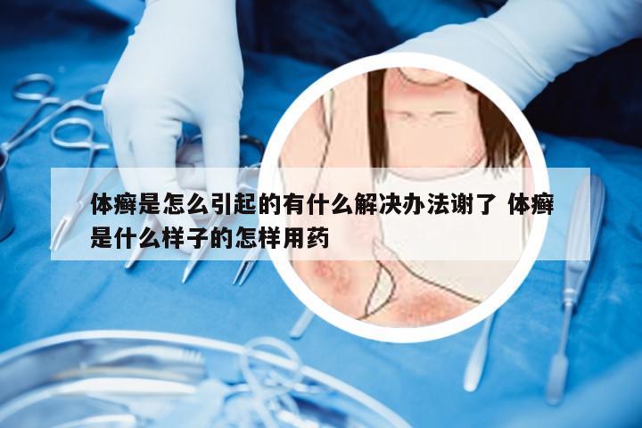 体癣是怎么引起的有什么解决办法谢了 体癣是什么样子的怎样用药