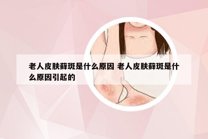 老人皮肤藓斑是什么原因 老人皮肤藓斑是什么原因引起的