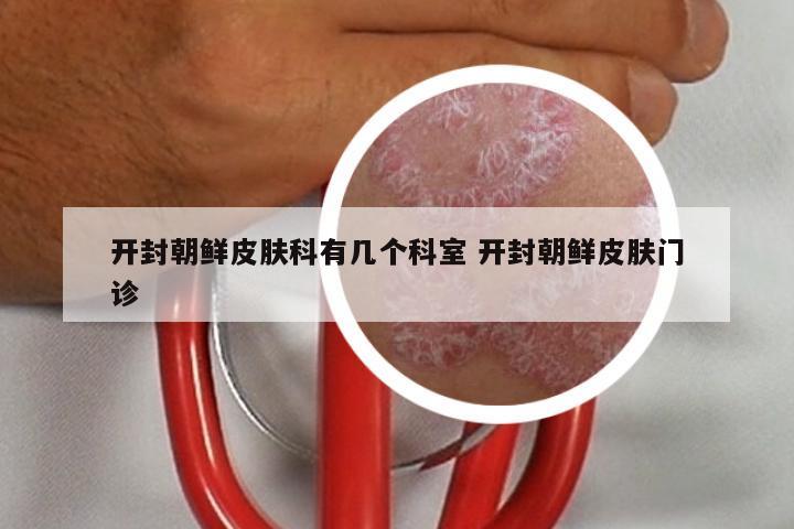 开封朝鲜皮肤科有几个科室 开封朝鲜皮肤门诊
