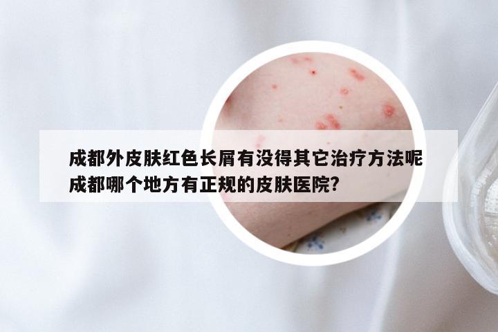 成都外皮肤红色长屑有没得其它治疗方法呢 成都哪个地方有正规的皮肤医院?