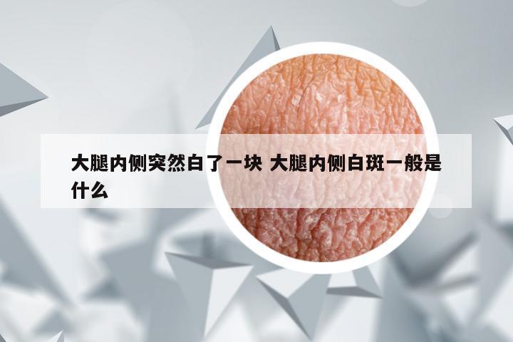 大腿内侧突然白了一块 大腿内侧白斑一般是什么