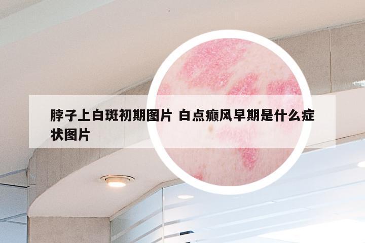 脖子上白斑初期图片 白点癫风早期是什么症状图片