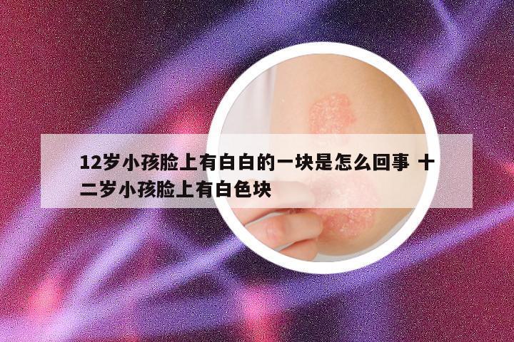12岁小孩脸上有白白的一块是怎么回事 十二岁小孩脸上有白色块
