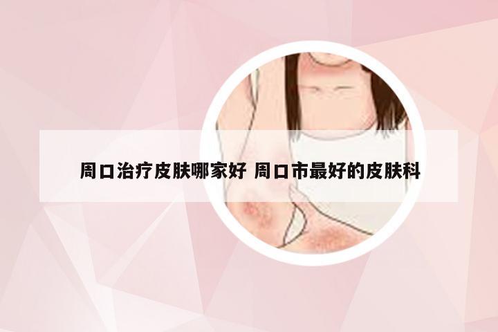 周口治疗皮肤哪家好 周口市最好的皮肤科
