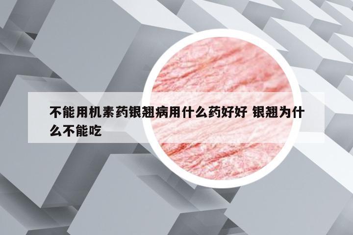 不能用机素药银翘病用什么药好好 银翘为什么不能吃
