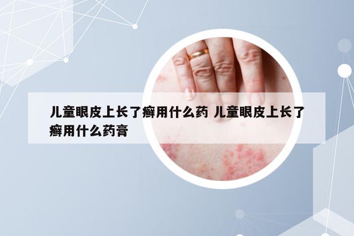 儿童眼皮上长了癣用什么药 儿童眼皮上长了癣用什么药膏