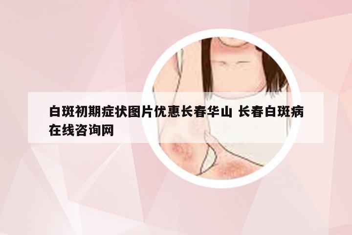白斑初期症状图片优惠长春华山 长春白斑病在线咨询网